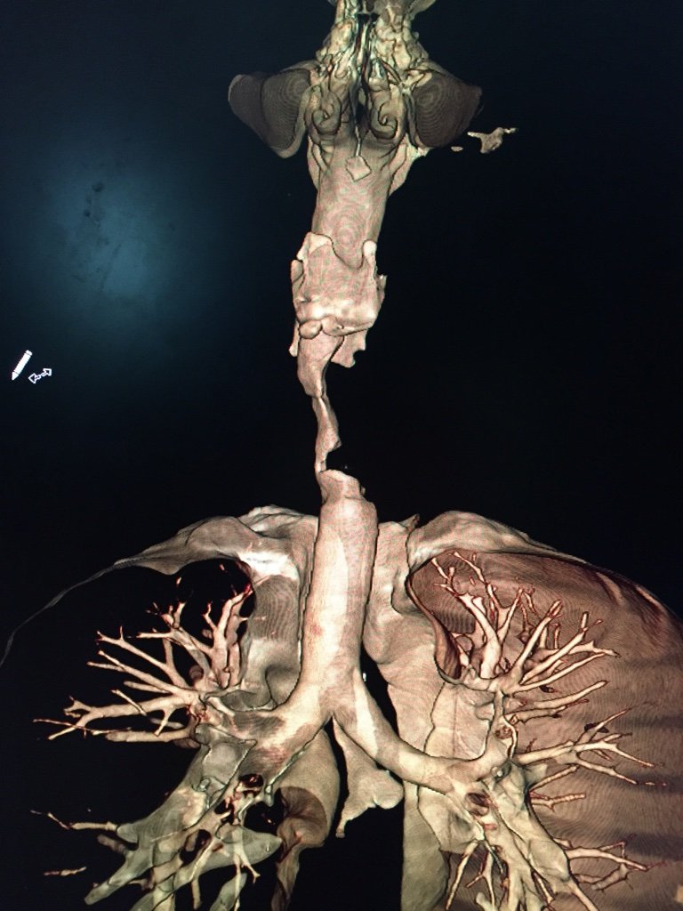 997E24F3 57C2 4998 87BE EE6242BF14EC_1_105_c.jpeg